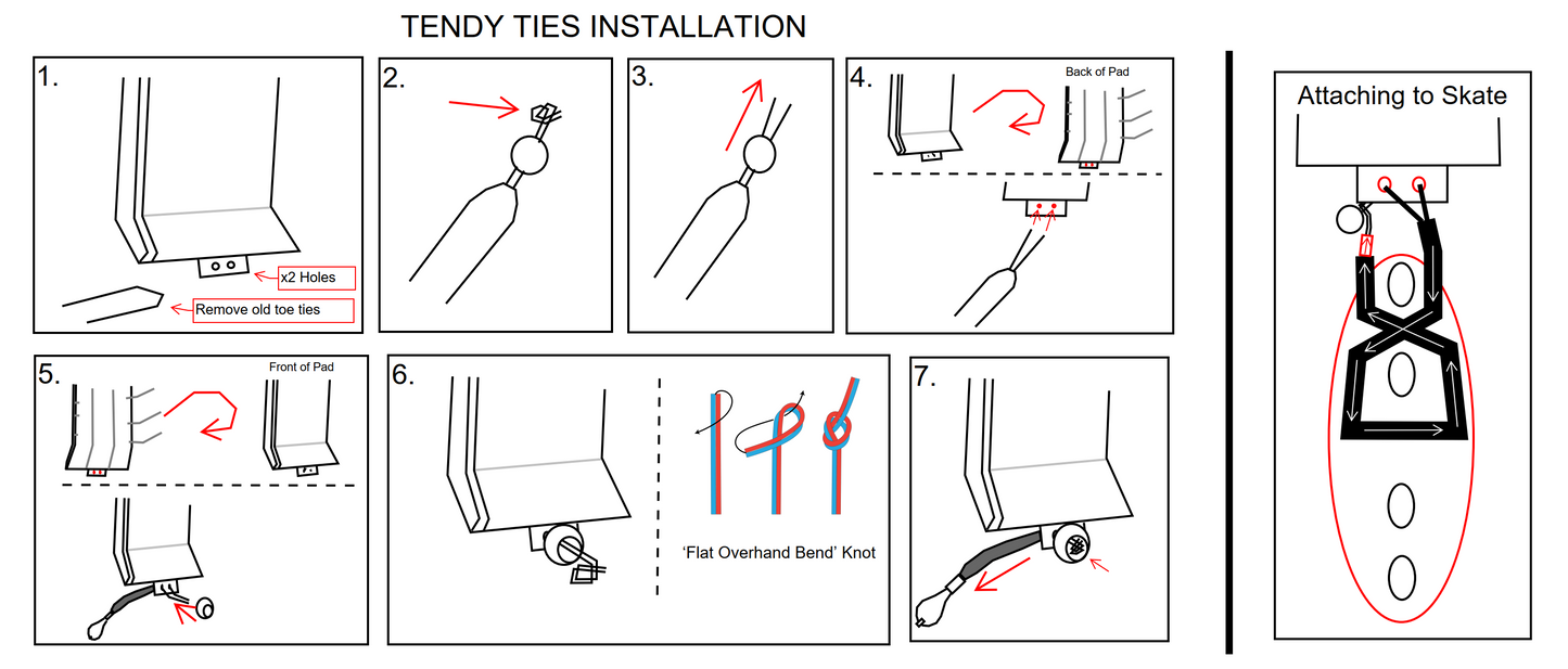 Tendy Ties - Toe Tie Replacement Kit